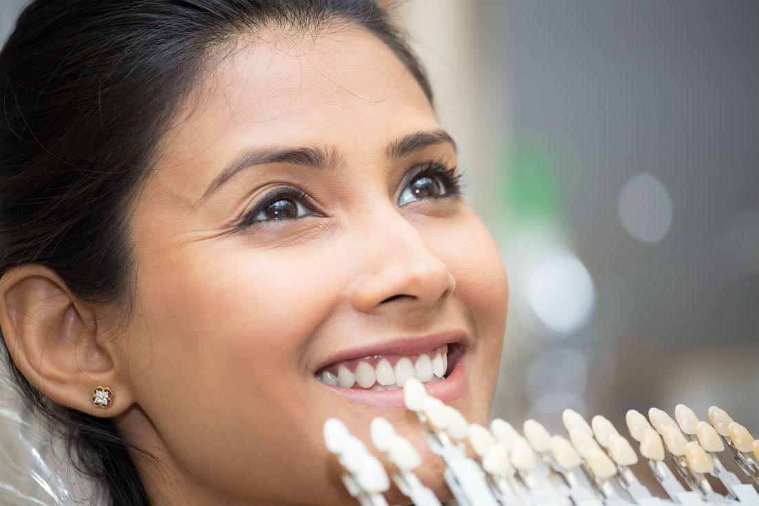 Veneers Lutherville-Timonium, MD