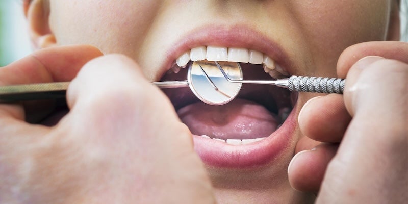 Dental exam in Timonium, MD