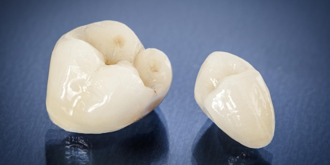 Dental crowns in Timonium, MD