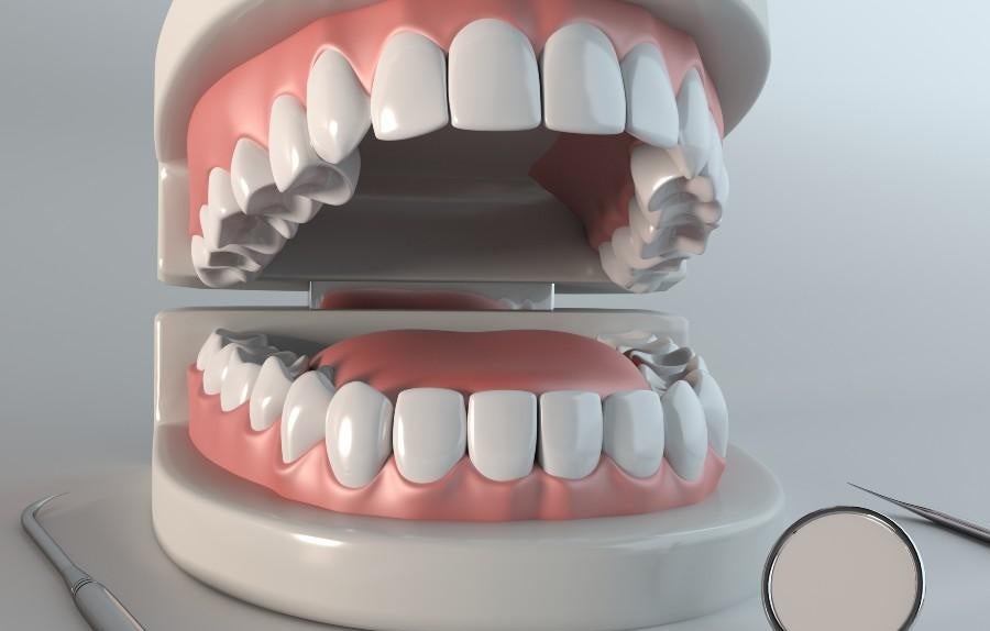 Full mouth reconstruction in Timonium, MD